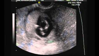 Babszi 2011 04 22 Xvid