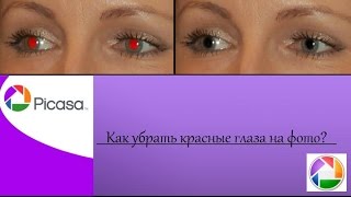 воспaленные прыщи фото