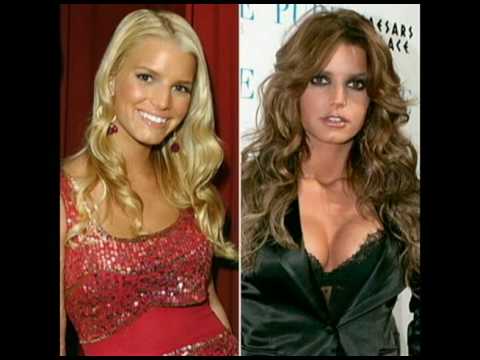 Celebrity Nose Jobs