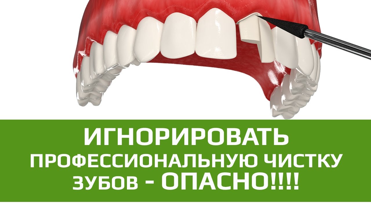 Как удалить зуб в государственной поликлинике Как удалить зуб в государственной поликлинике