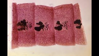 Diphyllobothrium The Largest Known Tapeworms That Can Infect People