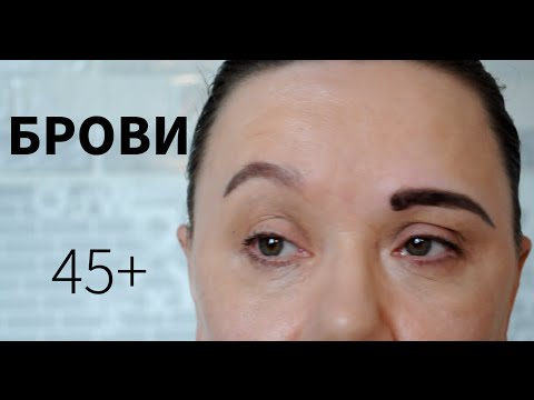 Проблема нет бровей Проблема нет бровей