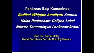 Whipple Ameliyatı Sonrası Nüks Pankreas Kanserinde Tamamlayıcı Total Pankreatektomi Dr Kemal Dolay