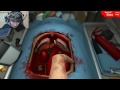 IL PAZIENTE E' INDEMONIATO?! O__O - Surgeon Simulator 2013 - Parte 5