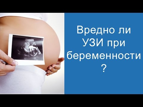 Вредно ли частое узи для беременной 58