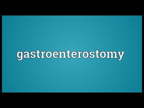 Header of gastroenterostomy