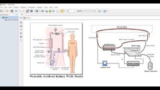 Wearable Artificial Kidney WAK | Matlab | Simulink model