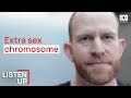 “I Was Born With An Extra Chromosome” | Listen Up | ABC Science