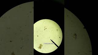 Moleküler Biyoloji Ve Genetik Okumak Ordu Üniversitesi Moleküler Biyoloji Genetik Mbg Tavsiyeleri