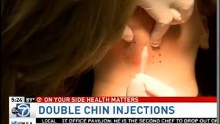 Double Chin Removal With Kybella Injections - Dr. Tina Alster on ABC7