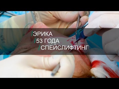 Спейслифтинг. Дорога пациента к новой жизни Спейслифтинг. Дорога пациента к новой жизни