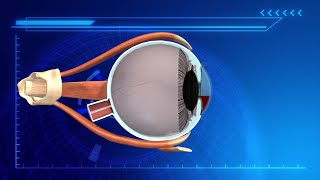 Nerf Guns Can Cause Eye Injuries, Say Doctors