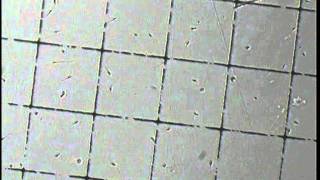 Male Sperm Washing for Intrauterine Insemination (IUI) or IVF - Post wash Semen