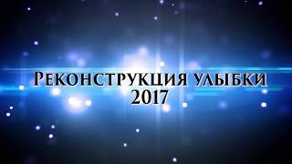 "Реконструкция улыбки 2017" от Александра Бабурова, Сургут. 14-15 октября 2017 г.