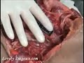 AUTOPSIA