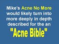 Acne Cures|acne remedy
