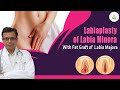 Labiaplasty of Labia Minora Reduction | Fat Transfer to Labia Majora | Care Well Medical Centre