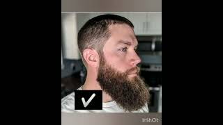 Sunnati Beard And Un Sunnati Beard