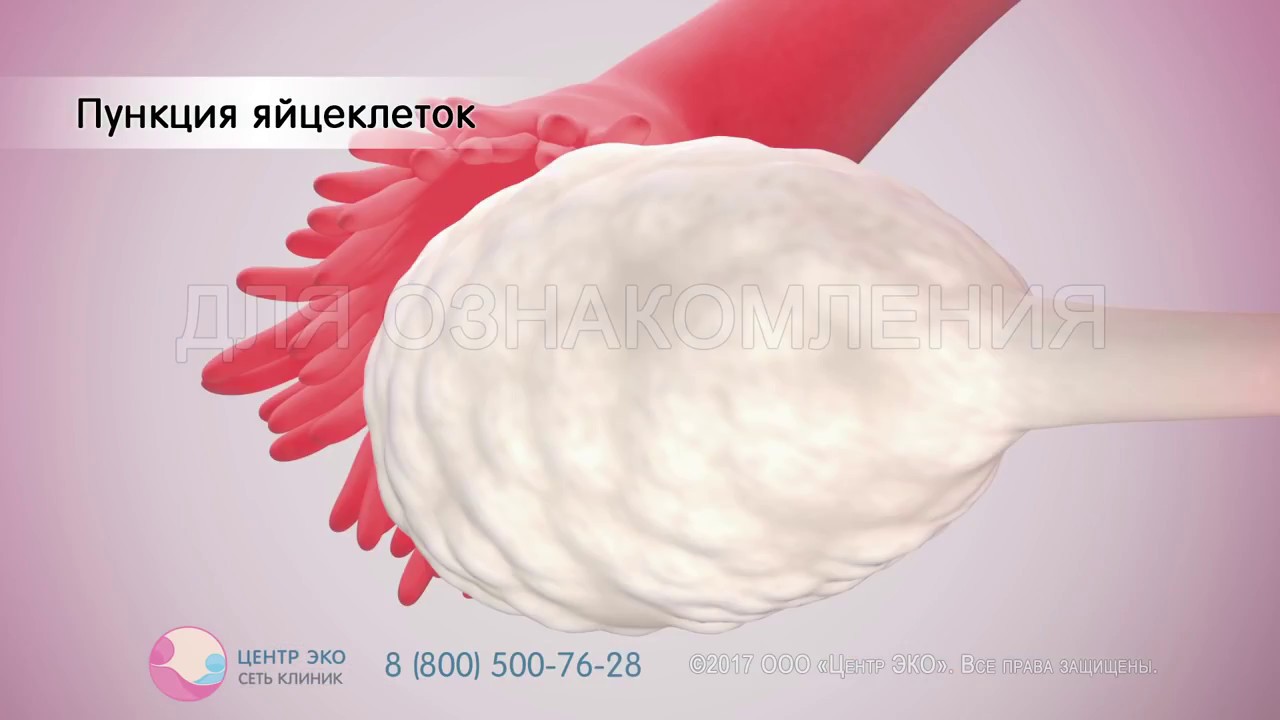 Как сделать эко и сколько стоит Как сделать эко и сколько стоит