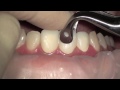 TOOTH!!