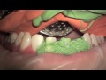 TOOTH!!