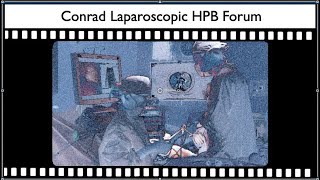 Laparoscopic Pancreas Surgery - Overview with video demonstrations