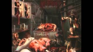 Watch Malignancy Mortality Weakness video