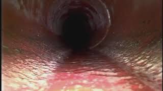 Sewer Scope Inspection (Birmingham, AL)