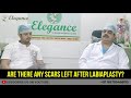 Labiaplasty Surgery | Labiaplasty Cost | Labial Reduction, Surat Gujarat, Mumbai Maharashtra, Indore