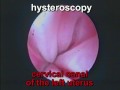 Uterus duplex and vagina duplex. Vaginoscopy. Hysteroscopy.