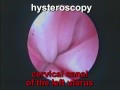 Uterus duplex and vagina duplex. Vaginoscopy. Hysteroscopy.