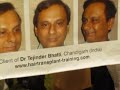 hair transplantation in India