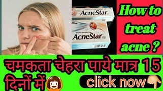 अगर आप चेहरा बेदाग़ चाहते है तो आपके लिए ये वीडियो देखना बहुत जरुरी है?😋tips for beauty,apply now👍