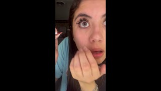 Woman Has Hairy Situation In Her Eye