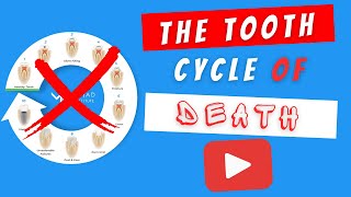 Save Teeth From Extractions & Root Cs Biomimetic Dentistry & The Tooth Cycle Of Death