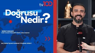 Saç Eki̇mi̇ İşlemi̇ Sonrasi İyi̇leşme Süreci̇ Murat Makasci Tv100 Doğrusu Nedi̇r?