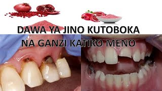 Dawa Ya Jino Lililo Toboka Na Ganzi Katika Meno