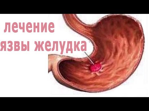 Лечить желудок в домашних условиях