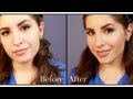 How to Cover Acne