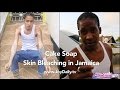Cake Soap.... Skin Bleaching in Jamaica (Full Documentary) Cake Soap.... Skin Bleaching in Jamaica (Full Documentary)