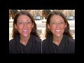Beauty Retouch Camera - Before/After Photos (Panasonic Lumin DMC-FX77)
