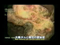 Video do intestino