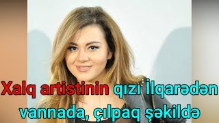 Xalq Artistinin Qızı İlqarədən Vannada, Çılpaq Şəkildə - Foto