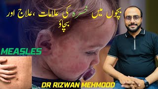 Measles In Children Treatment & Prevention Bachon Me Khasra Ka Ilaj Dr Rizwan Mehmood