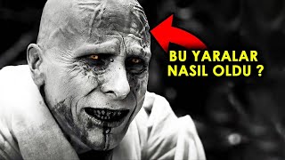 Thor Aşk Ve Gök Gürültüsü Gorrun Yara İzleri Nereden Geliyor?