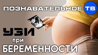 УЗИ при беременности (Познавательное ТВ, Ирина Волынец)