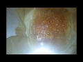 shatter