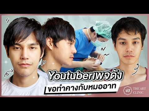 รีวิวเสริมคางผู้ชายที่ดีที่สุด : คางทรงนี้ หมออาทออกแบบเองที่ The Art Clinic