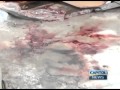 Post Mortem examinations of teen shot dead by Police conducted