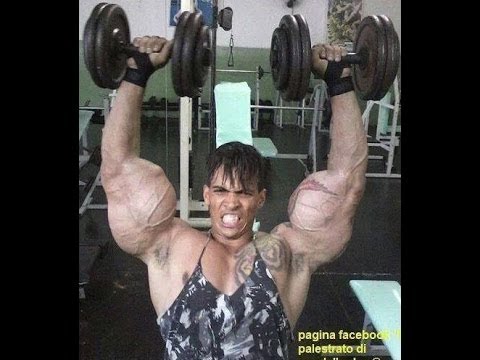 Anabolic steroids abuse